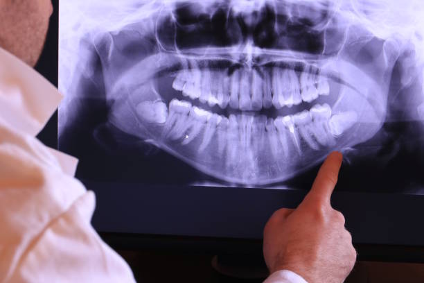 Best Emergency Dental Care for Broken or Chipped Teeth in Crete, NE